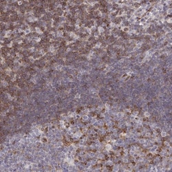 CHES1 Antibody, Novus Biologicals:Antibodies:Primary Antibodies